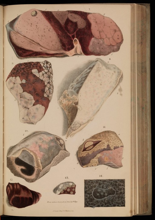 Figures 7-14, illustrations of morbid anatomy