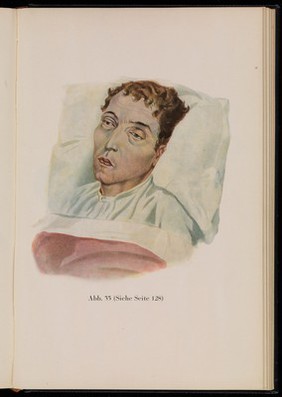 Kranken-Physiognomik / von K. H. Baumgärtner.