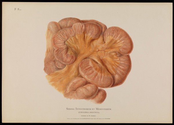 Illustrations of pathological anatomy : being a series of chromographed plates painted from nature immediately after death / with descriptive text by Alfred Kast and Theodor Rumpel ; English edition, revised and edited by M. Armand Ruffer.