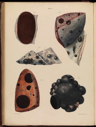 Pathological anatomy : illustrations of the elementary forms of disease / By Robert Carswell.