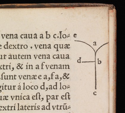 Apologetica disceptatio, qua docetur per quae loca sanguis mitti debeat in visceru[m] inflammationibus, pr[ae]sertim in pleuritide.