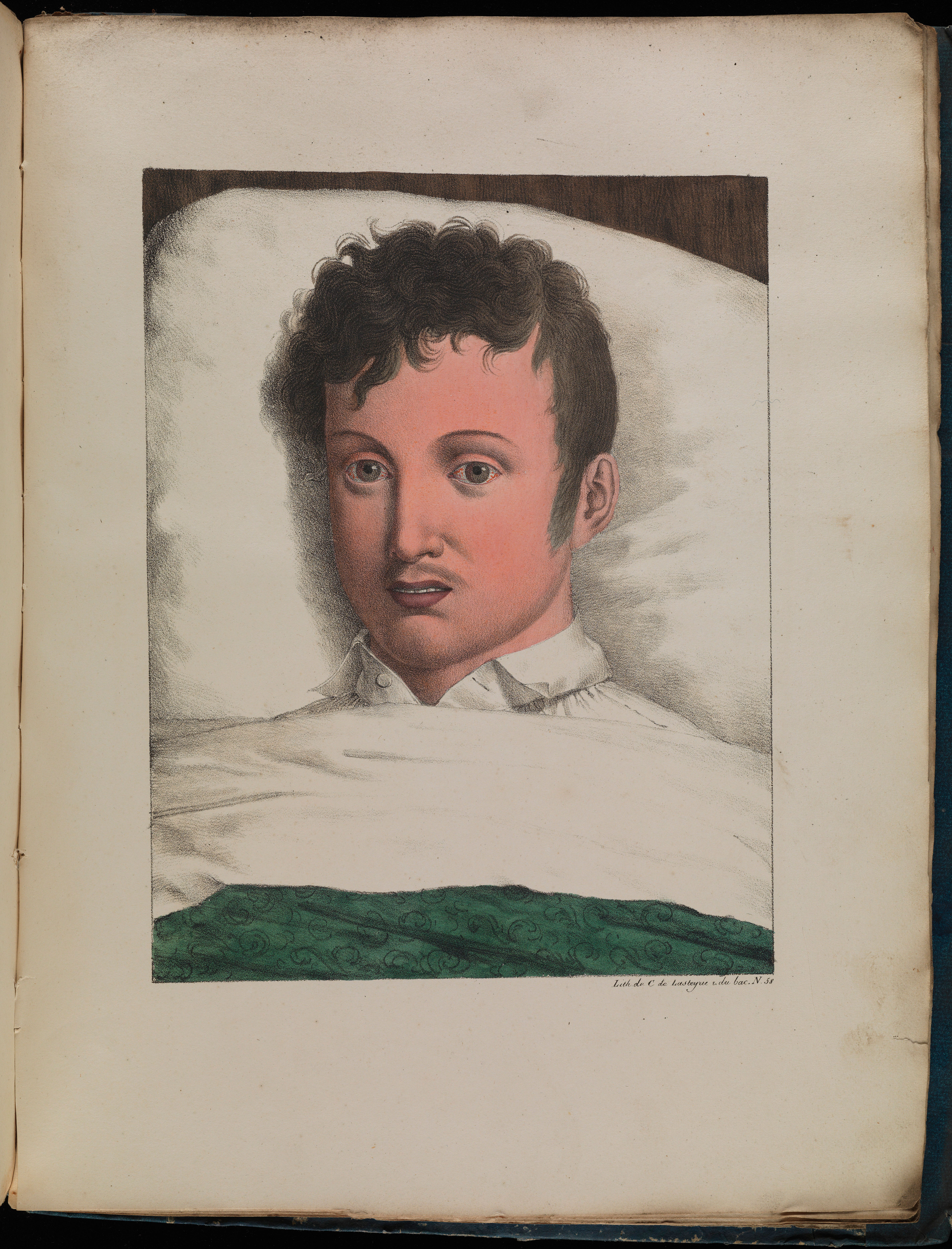 Development of yellow fever Collection