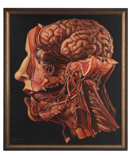 A human head dissected: "In memoriam". Acrylic painting by R. Ennis, 2001.