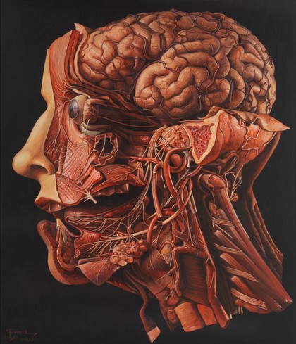 A human head dissected: "In memoriam". Acrylic painting by R. Ennis, 2001.