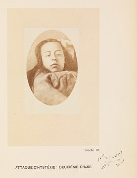 Iconographie photographique de la Salpêtrière : service de M. Charcot / par Bourneville et P. Regnard.