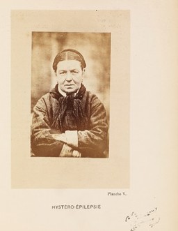Iconographie photographique de la Salpêtrière : service de M. Charcot / par Bourneville et P. Regnard.