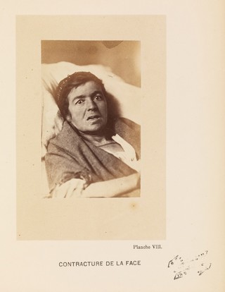 Iconographie photographique de la Salpêtrière : service de M. Charcot / par Bourneville et P. Regnard.
