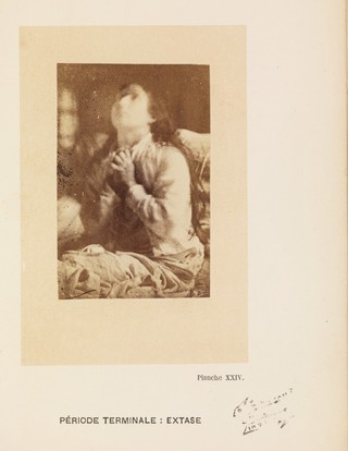 Iconographie photographique de la Salpêtrière : service de M. Charcot / par Bourneville et P. Regnard.