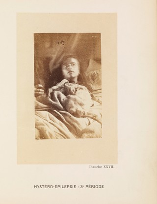 Iconographie photographique de la Salpêtrière : service de M. Charcot / par Bourneville et P. Regnard.