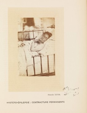 Iconographie photographique de la Salpêtrière : service de M. Charcot / par Bourneville et P. Regnard.