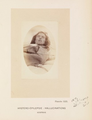 Iconographie photographique de la Salpêtrière : service de M. Charcot / par Bourneville et P. Regnard.