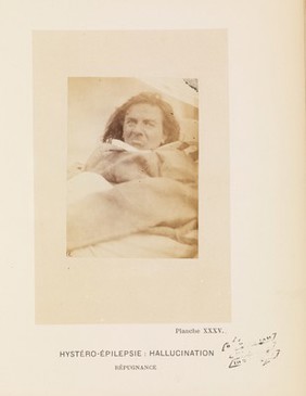 Iconographie photographique de la Salpêtrière : service de M. Charcot / par Bourneville et P. Regnard.