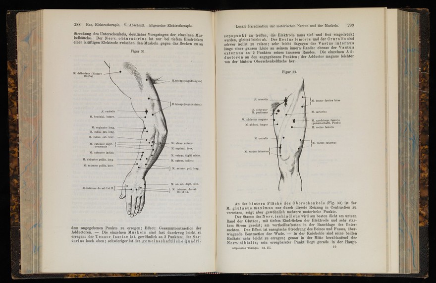 Handbuch der Elektrotherapie / von Wilhelm Erb.