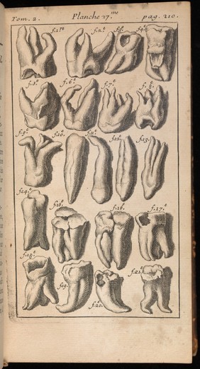 Le chirurgien dentiste, ou traité des dents. Ou l'on l'enseigne les moyens de les entretenir propres &c saines : de les embellir d'en réparer la perte &c de remédier à leurs maladies, à celles des gencives &c aux accidens qui peuvent survenir aux autres parties voisines des dents ... / par Pierre Fauchard.