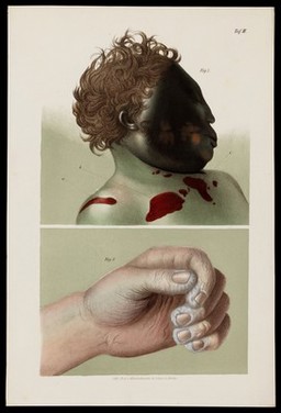 Practisches Handbuch der gerichtlichen Medicin : nach eigenen Erfahrungen / von Johann Ludwig Casper.