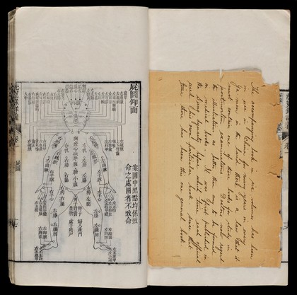 Chinese diagram of human body, handwritten letter in English.