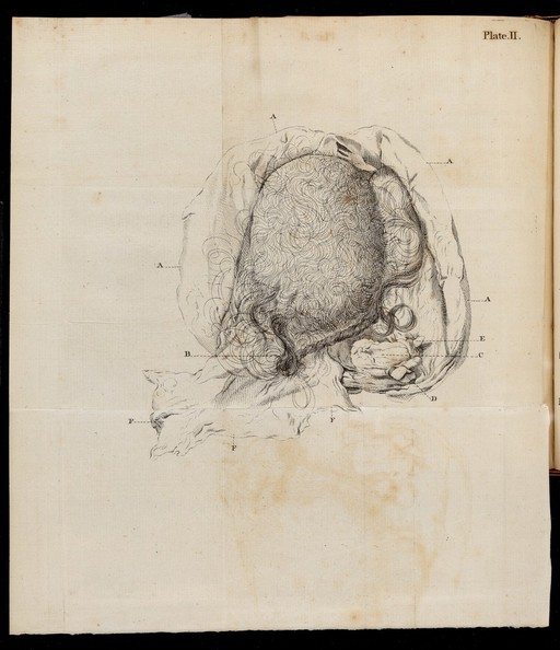 Plate II, illustration of an ovarium.