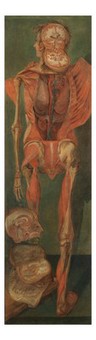 A standing dissected man, posterior view, with separate sections of the brain. Oil painting by Jacques-Fabien Gautier D'Agoty, 1764/1765.