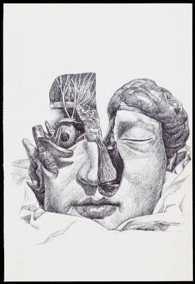 A human head partially dissected and seen from the front. Drawing by R. Ennis, 2007.