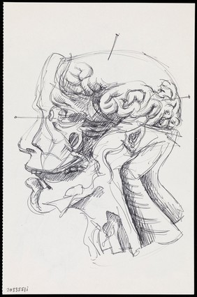 A human head and neck dissected and seen from the side: two figures. Drawing by R. Ennis, 2001.