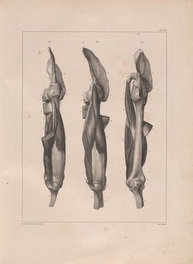 Traité complet de l'anatomie de l'homme comprenant la médecine opératoire ... : avec planches lithographiées ... / par N.H. Jacob.