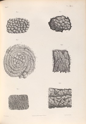 Traité complet de l'anatomie de l'homme comprenant la médecine opératoire ... : avec planches lithographiées ... / par N.H. Jacob.