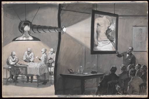 An operation being viewed through a periscope