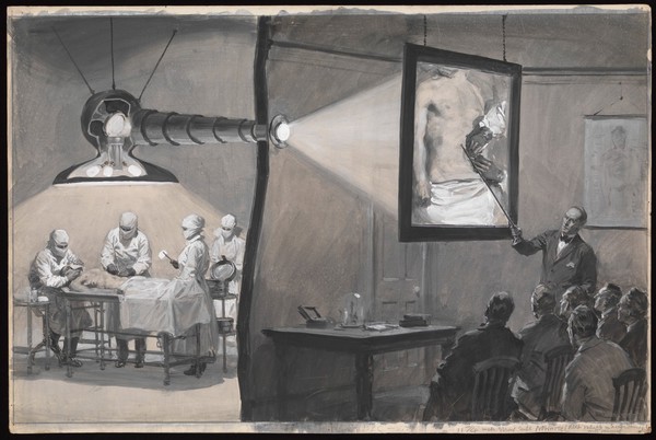 A periscope being used above an operation which is projected onto a lantern screen for a lecture in the adjoining room. Gouache painting by W.R. Seton.