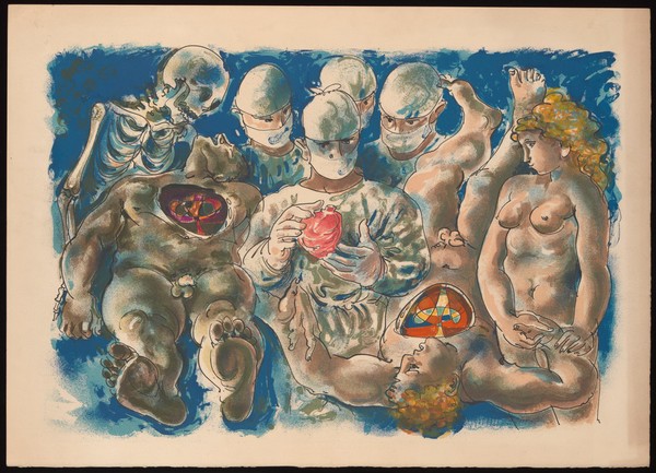 Heart transplantation: surgeons contemplate a heart; a skeleton (Death) consoles the dead donor; a nude woman comforts the living donor. Colour lithograph.