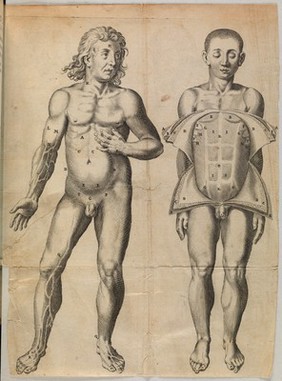 Encheiridium anatomicum, et pathologicum, in quo ex naturali constitutione partium, recessus à naturali statu demonstratur / [Jean Riolan].