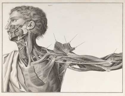 Sull'aneurisma / riflessioni ed osservazioni anatomico-chirurgiche. Di Antonio Scarpa.