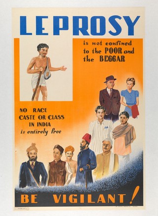 Leprosy: patients showing symptoms. Colour lithograph.