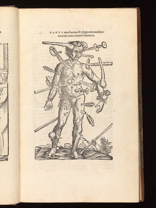 Physicas Hildegardis : Elementorum, fluminum aliquot Germaniae, metallorum, leguminum, fructuum, & herbarum: arborum, & arbustorum: piscium deni[que], volatilium, & animantium terrae naturas & operationes : IIII. Libris mirabili experientia posteritati tradens. Oribasii medici de simplicibus libri quinque. Theodori physici dieta, docens quibusnam salubriter utendum, uel abstinendum. Esculapii liber vnus, de morborum, infirmitatum, passionum[que] corporis humani caussis, descriptionibus, & cura.