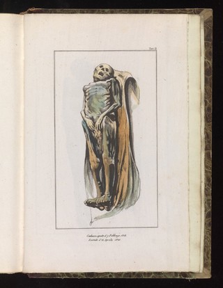 Trattato delle esumazioni giudiziarie e considerazioni sopra i cangiamenti fisici cui vanno soggetti i cadaveri, nella loro putrefazione entro la terra, nell'acqua, nelle fogne e nei letamaj ... / Traduzione italiana dei dottori Castelli Salvatore ... e G. Ganz.