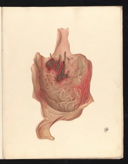 Illustrations of the effects of poisons : by George Leith Roupell ; the plates from original drawings by Andrew Melville M'Whinnie.