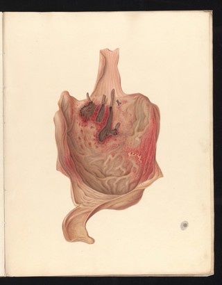 Illustrations of the effects of poisons : by George Leith Roupell ; the plates from original drawings by Andrew Melville M'Whinnie.