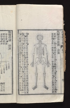 view Diagram of a skeleton.