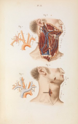 view Plate 11, The common carotid arteries.