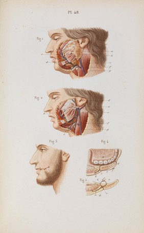 Précis iconographique de médecine opératoire et d'anatomie chirurgicale / [Claude Bernard].