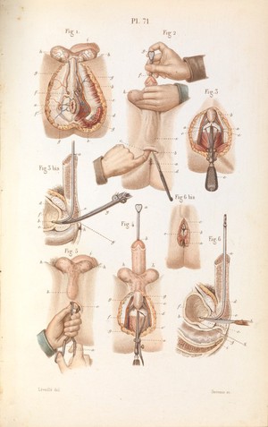 view Plate 71, Surgical anatomy of the perineum and rectum.