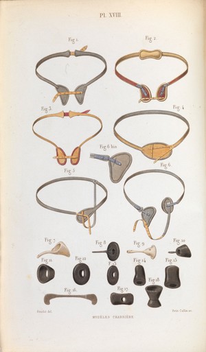 view Plate XVIII, Various types of hernia trusses and pessaries.