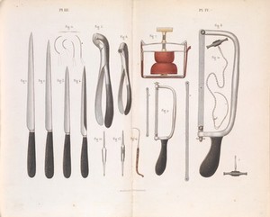view Plates III-IV, Surgical instruments used for amputations.