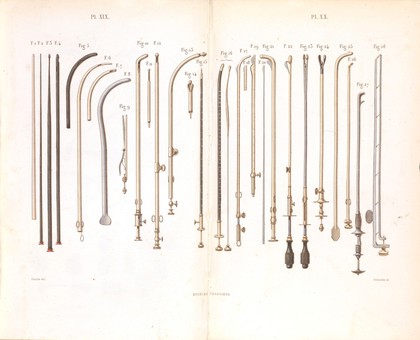 Plate XIX-XX, Surgical instruments for the treatment of diseases in the ureter and prostate.