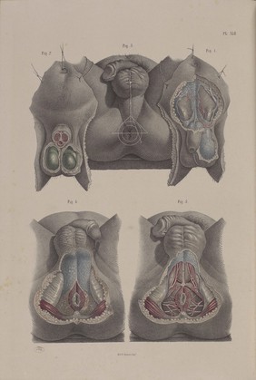 Plate XLII. Surgical dissection of the male perineum.