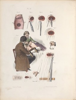 The surgery, surgical pathology and surgical anatomy of the female pelvic organs : in a series of colored plates taken from nature with commentaries, notes and cases / by Henry Savage, M.D.