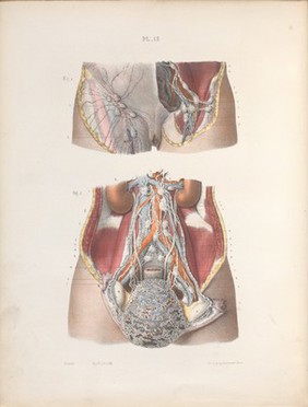 The surgery, surgical pathology and surgical anatomy of the female pelvic organs : in a series of colored plates taken from nature with commentaries, notes and cases / by Henry Savage, M.D.