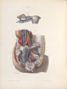 The surgery, surgical pathology and surgical anatomy of the female pelvic organs : in a series of colored plates taken from nature with commentaries, notes and cases / by Henry Savage, M.D.