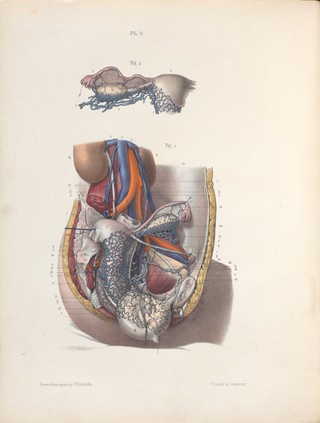 The surgery, surgical pathology and surgical anatomy of the female pelvic organs : in a series of colored plates taken from nature with commentaries, notes and cases / by Henry Savage, M.D.