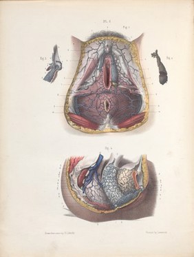 The surgery, surgical pathology and surgical anatomy of the female pelvic organs : in a series of colored plates taken from nature with commentaries, notes and cases / by Henry Savage, M.D.