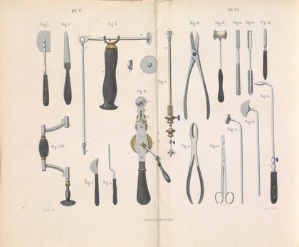Plate V-VI, Surgical instruments used for resection surgery.